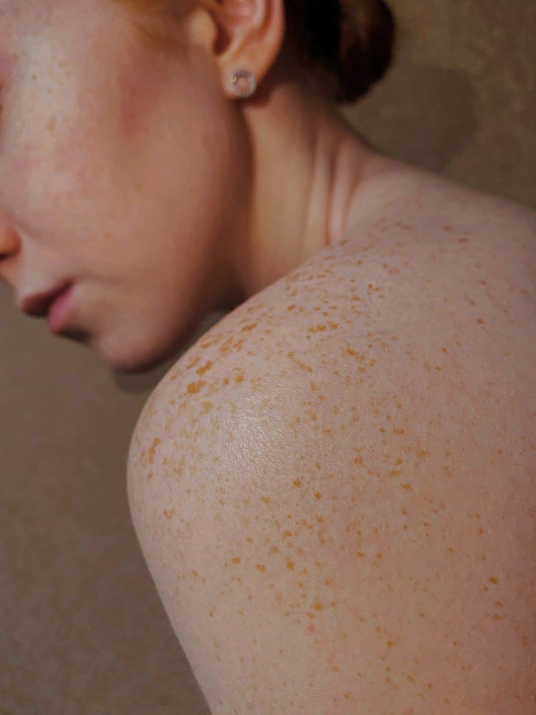 Womans Freckled Shoulder   Kavahana